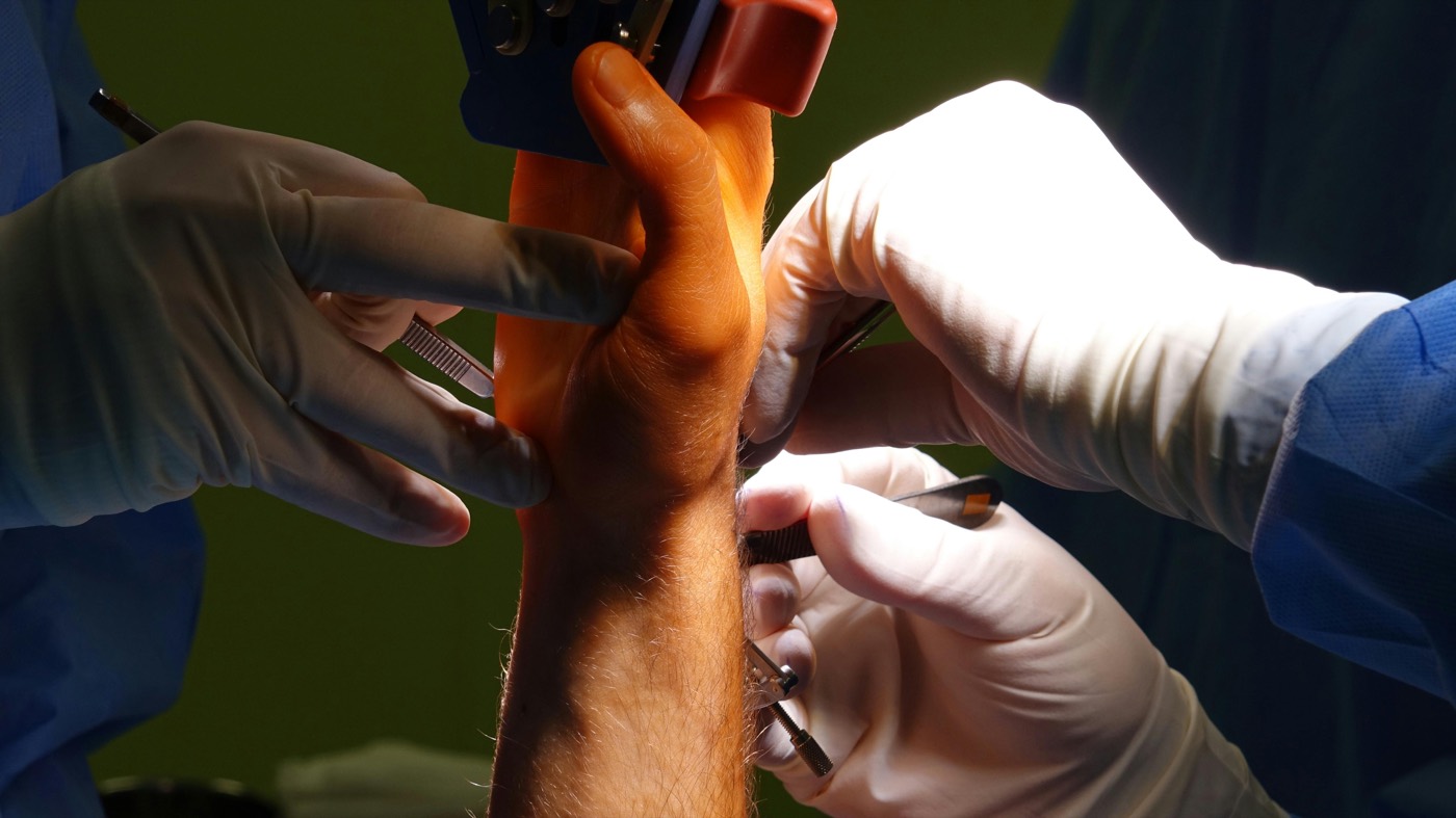 Cirugía de fracturas